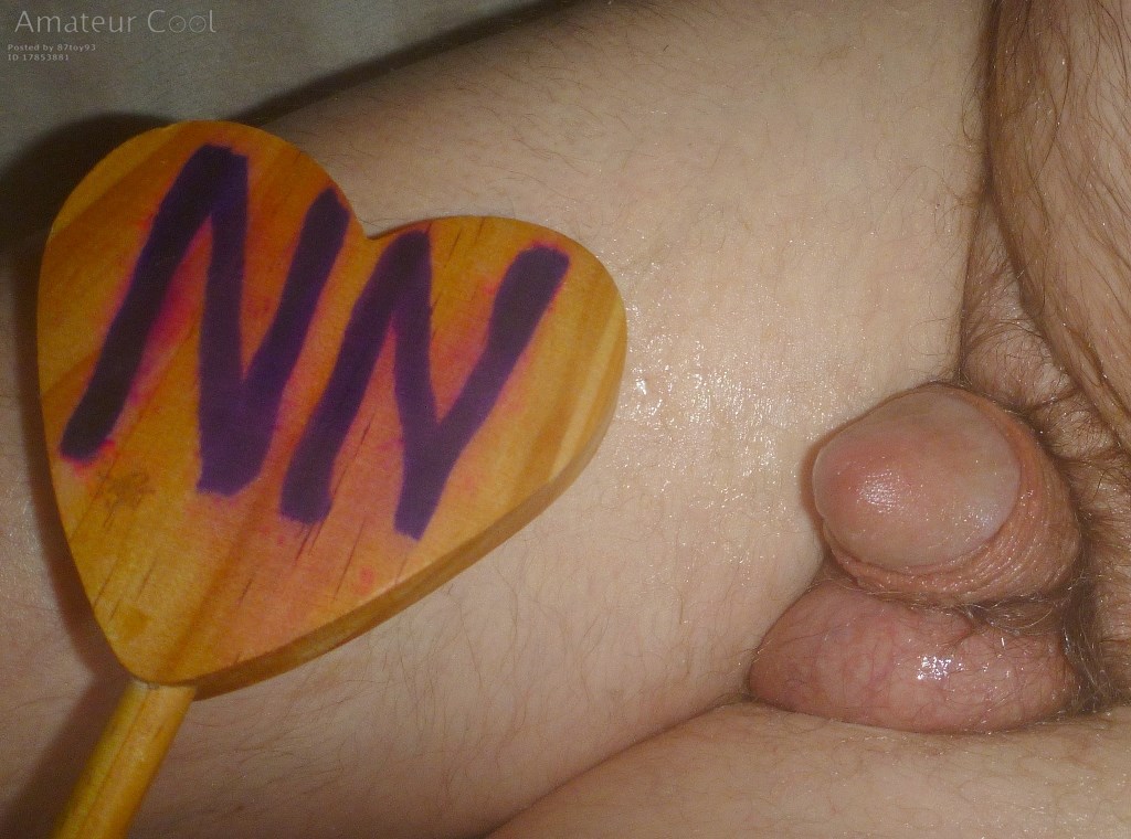 A frontal and left sided flaccid view in late April 2025.